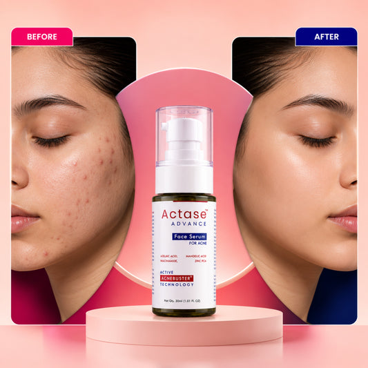 Actase Advance