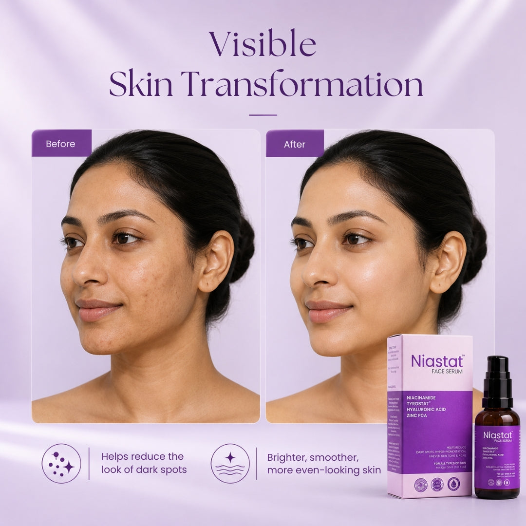 Niastat serum