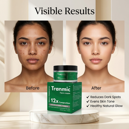Tranmic Depigmenting cream
