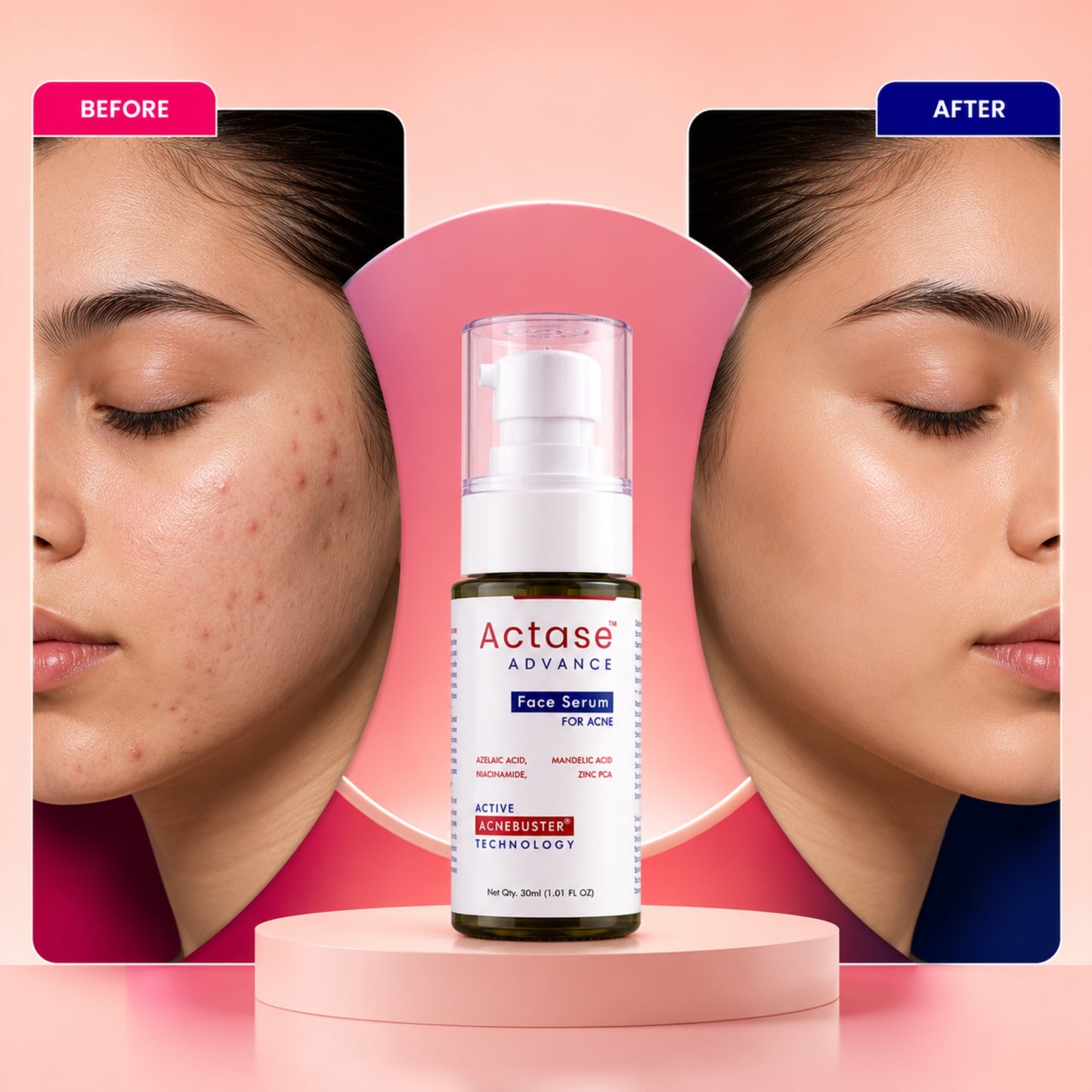 Actase Advance